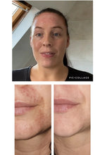 Load image into Gallery viewer, *NEW* Plant Based Steroid Free Sensitive Skin &amp; Scalp Solution (Angry,flakey,steroid withdrawal prone, irritated skin of all ages)